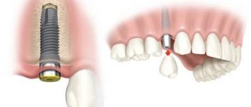 especialidade odontológica