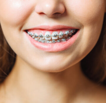 Aparelho odontologico funciona?
